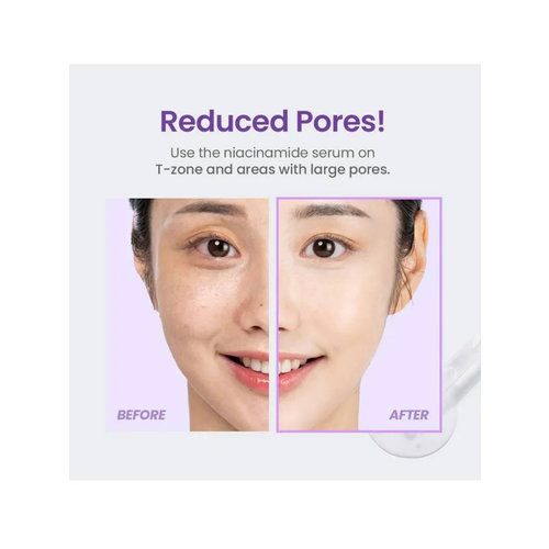 Serum Niacinamide 20% 30ml