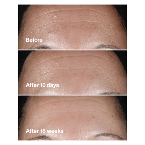 Smart Clinical Repair™ Wrinkle Correcting Serum 75ml