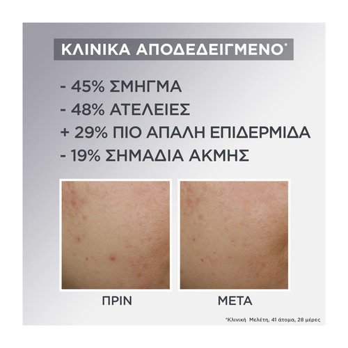 Garnier Ρουτίνα Περιποίησης Προσώπου 3 Βημάτων Κατά Των Ατελειών